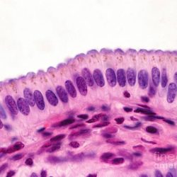 Squamous epithelium microscope 400x epithelial kourtney