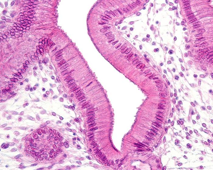 Simple columnar epithelium under microscope 400x