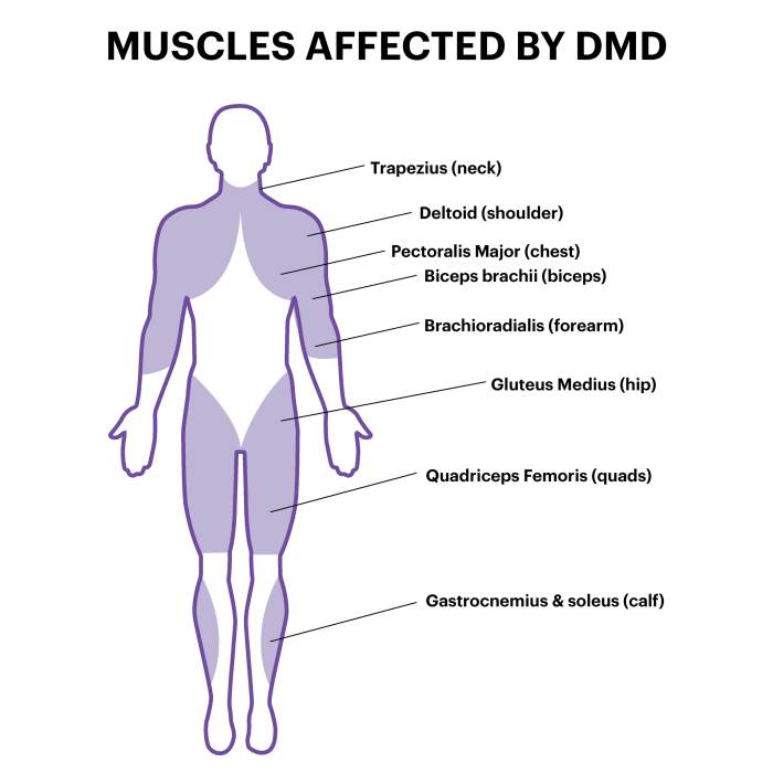 Muscles affected by massage are generally manipulated from the: